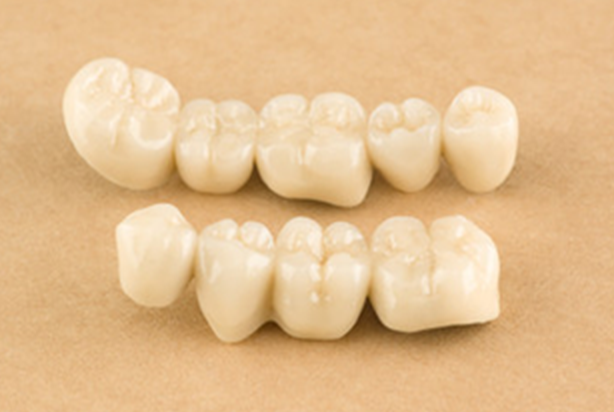 歯を美しくする歯科素材で“キレイ”を手に入れる